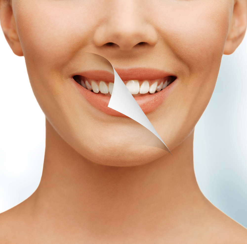 yellow teeth go away to reveal whiter smile